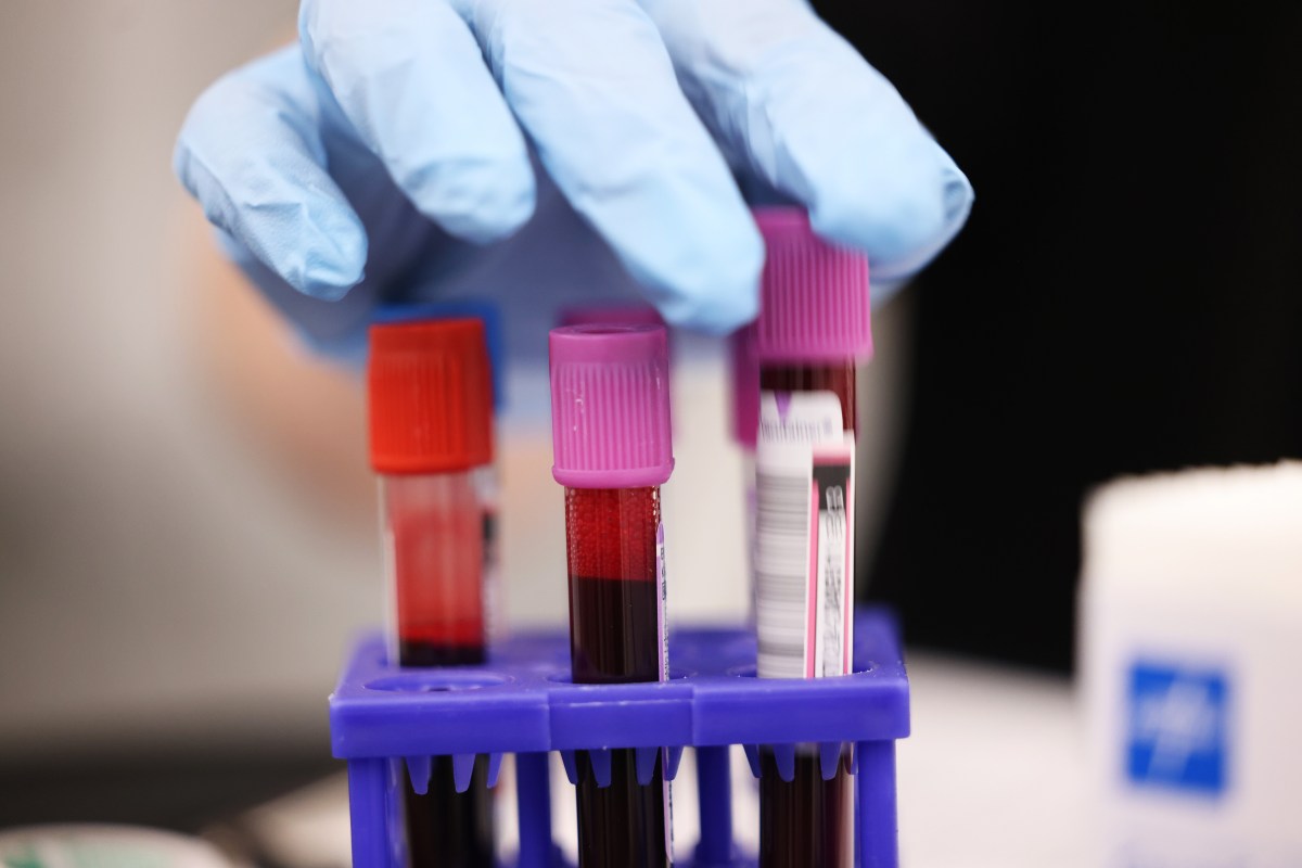 A major blood donation giant in the United States after ransomware attack warns confusion