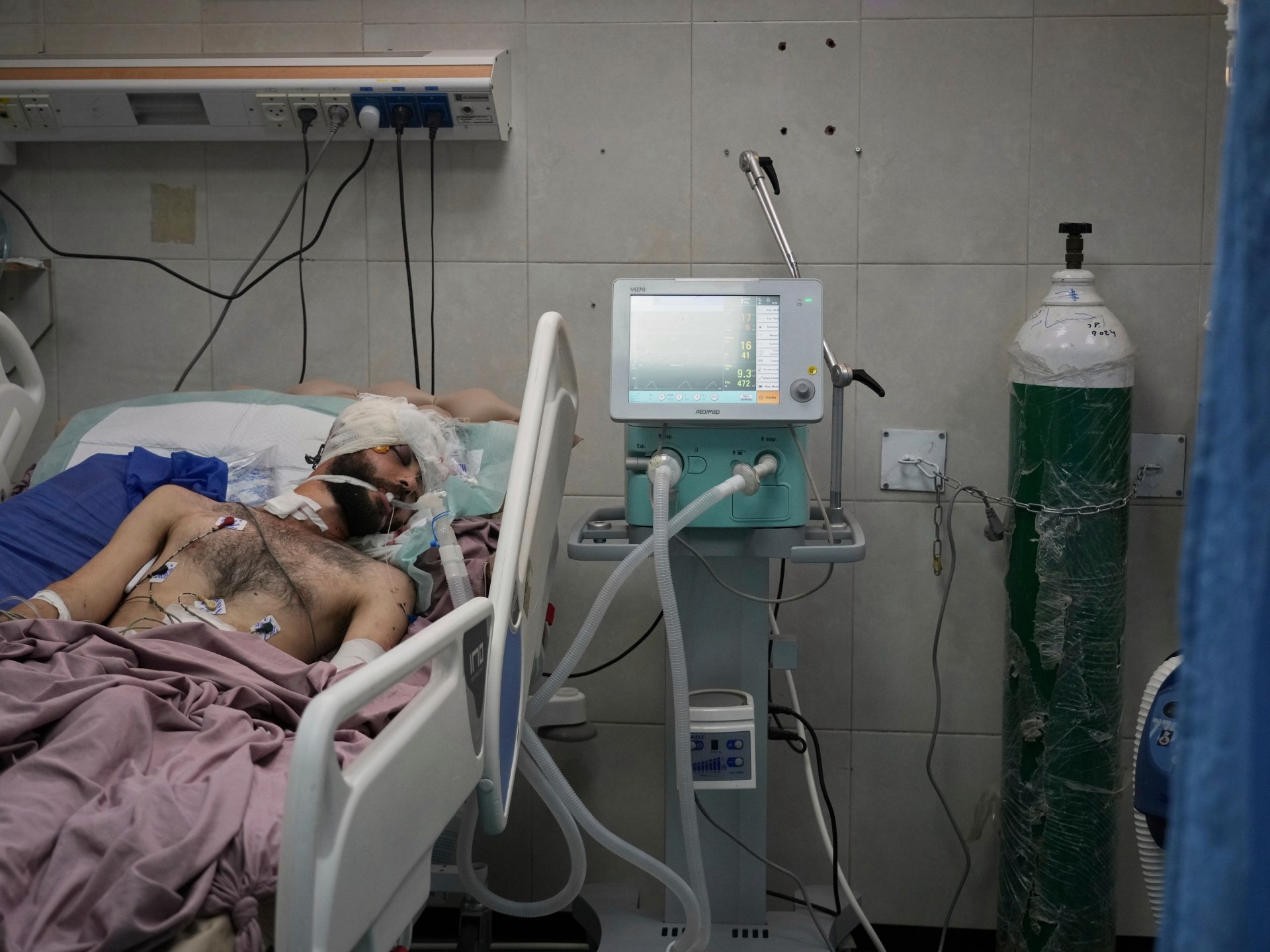 Gaza hospitals cannot provide food to recovering patients Israeli-Palestinian conflict news