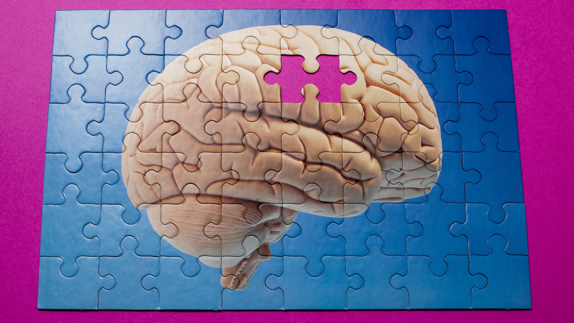 Vaccines hold appetite-stimulating promises in the fight against dementia