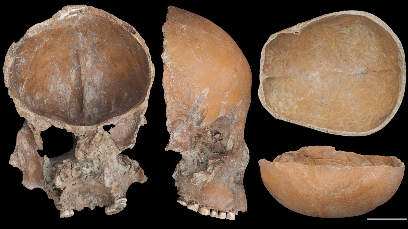 5,000 years ago, Stone Age people in China fashioned the bones of their ancestors into cups and masks.