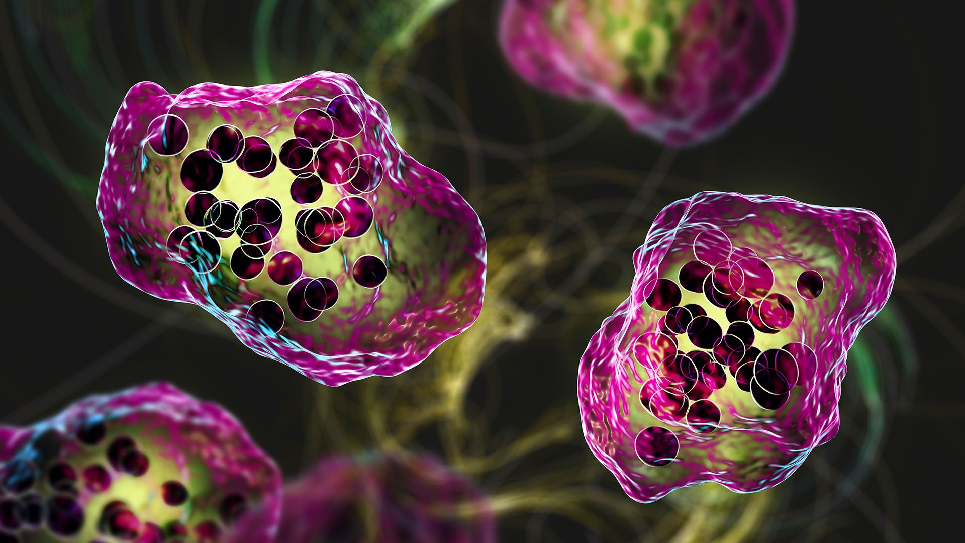 South Carolina measles outbreak is the largest since the U.S. eradicated measles