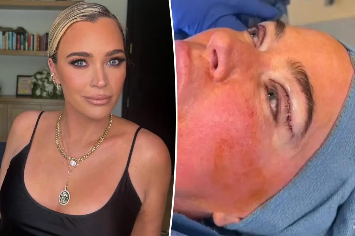 Teddi Mellencamp defends plastic surgery procedure during cancer treatment
