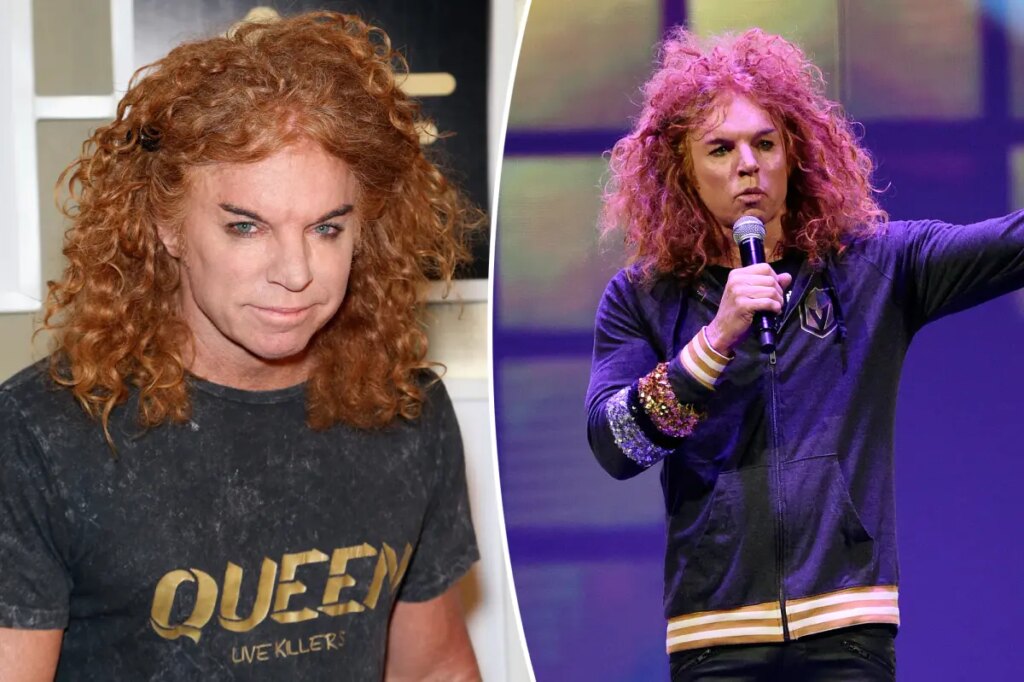 Carrot Top breaks silence after suicide attempt
